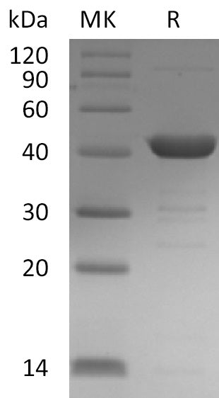 BL-1277NP: Greater than 95% as determined by reducing SDS-PAGE. (QC verified)Recombinant Human UPB1 Protein (C-6His)