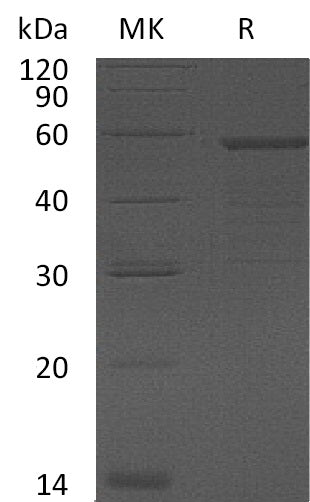BL-1282NP: Greater than 95% as determined by reducing SDS-PAGE. (QC verified)Recombinant Human GAS-7 Protein (N-6His)