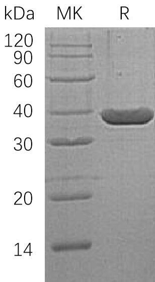 BL-1288NP: Greater than 95% as determined by reducing SDS-PAGE. (QC verified)Recombinant Human LDH-A Protein (N-6His)