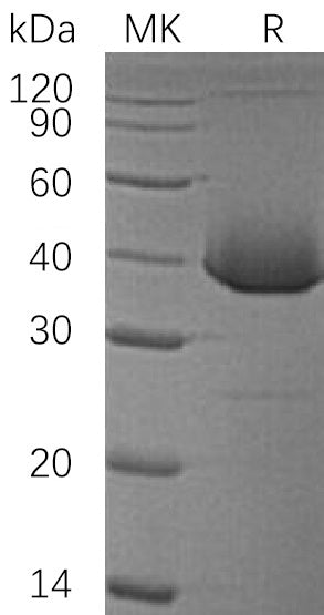 BL-1289NP: Greater than 95% as determined by reducing SDS-PAGE. (QC verified)Recombinant Human LDH-B Protein (N-6His)