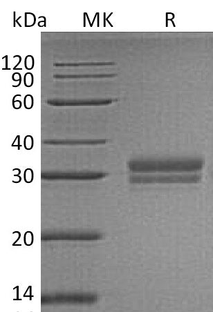 BL-0540NP: Greater than 95% as determined by reducing SDS-PAGE. (QC verified)Recombinant Human VSIG2 Protein (C-6His)