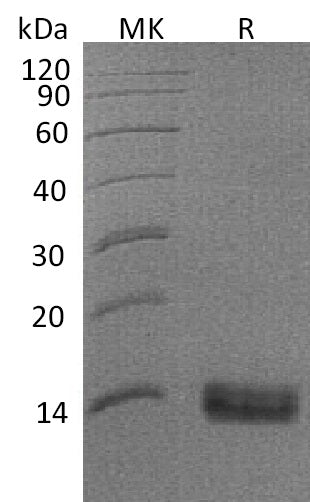 BL-1355NP: Greater than 95% as determined by reducing SDS-PAGE. (QC verified)Recombinant Human SPINK1 Protein (C-6His)