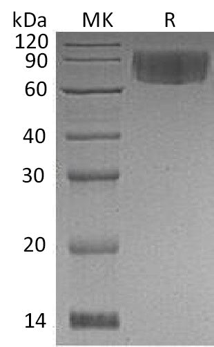 BL-0539NP: Greater than 95% as determined by reducing SDS-PAGE. (QC verified)Recombinant Human VNN1 Protein (C-6His)
