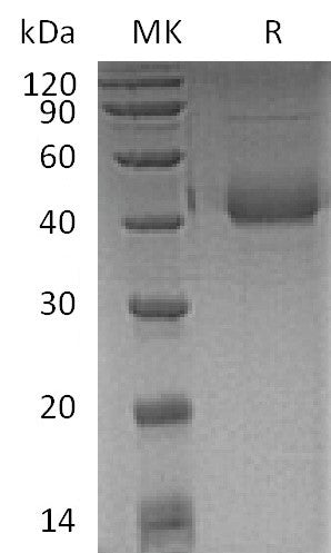 BL-0534NP: Greater than 95% as determined by reducing SDS-PAGE. (QC verified)Recombinant Human SP-D Protein (C-6His)