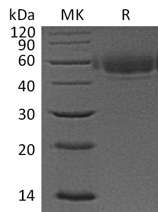 BL-0541NP: Greater than 95% as determined by reducing SDS-PAGE. (QC verified)Recombinant Human VSIG4 Protein (C-6His)