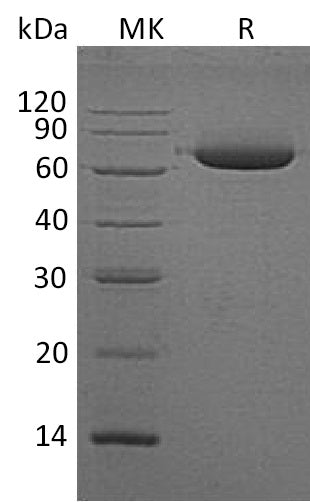 BL-1356NP: Greater than 95% as determined by reducing SDS-PAGE. (QC verified)Recombinant Human ALPL Protein (C-6His)