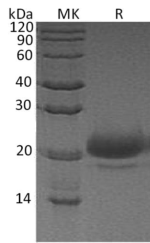 BL-0542NP: Greater than 95% as determined by reducing SDS-PAGE. (QC verified)Recombinant Human WFDC2 Protein (C-6His)