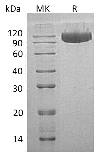 BL-0532NP: Greater than 95% as determined by reducing SDS-PAGE. (QC verified)Recombinant Human Serpin G1 Protein (C-6His)