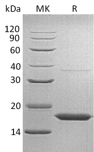BL-0537NP: Greater than 95% as determined by reducing SDS-PAGE. (QC verified)Recombinant Human TTR Protein (C-6His)