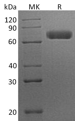 BL-1229NP: Greater than 95% as determined by reducing SDS-PAGE. (QC verified)Recombinant Human EphA7 Protein (C-6His)