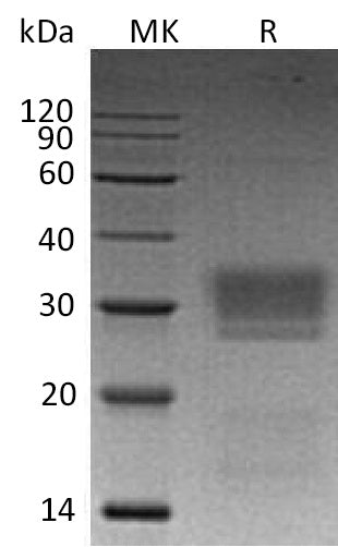 BL-0511NP: Greater than 95% as determined by reducing SDS-PAGE. (QC verified)Recombinant Human NKG2DL2 Protein (C-6His)