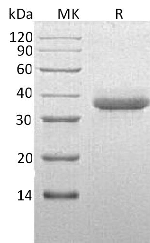 BL-1351NP: Greater than 95% as determined by reducing SDS-PAGE. (QC verified)Recombinant Human CTRC Protein (C-6His)