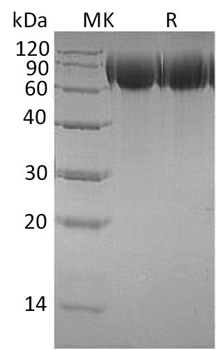 BL-1228NP: Greater than 95% as determined by reducing SDS-PAGE. (QC verified)Recombinant Human TrkB Protein (C-6His)