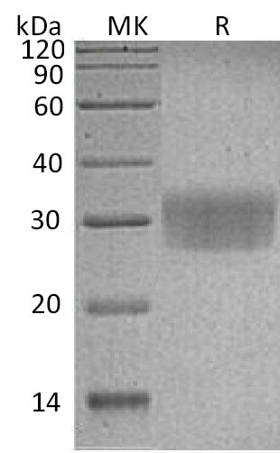 BL-0517NP: Greater than 95% as determined by reducing SDS-PAGE. (QC verified)Recombinant Human CD7 Protein (C-6His)
