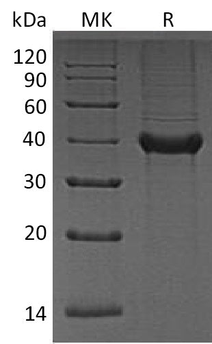 BL-1350NP: Greater than 95% as determined by reducing SDS-PAGE. (QC verified)Recombinant Human B4GALT4 Protein (C-6His)