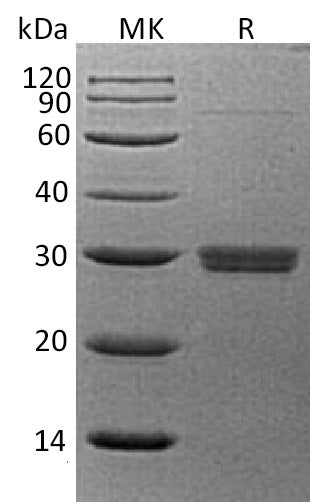 BL-0512NP: Greater than 95% as determined by reducing SDS-PAGE. (QC verified)Recombinant Human SAP Protein (C-6His)