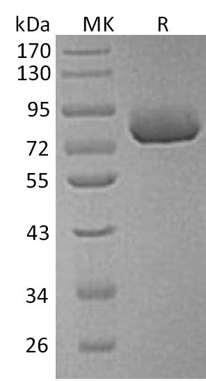 BL-1349NP: Greater than 95% as determined by reducing SDS-PAGE. (QC verified)Recombinant Human XPNPEP2 Protein (C-6His)