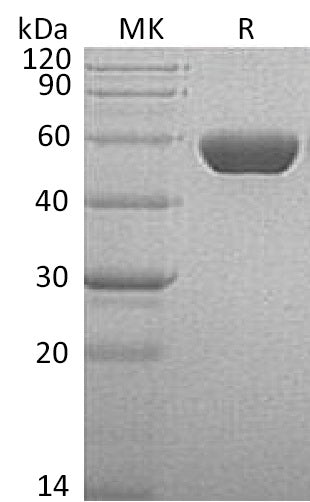 BL-0527NP: Greater than 95% as determined by reducing SDS-PAGE. (QC verified)Recombinant Human Serpin A1 Protein (C-6His)