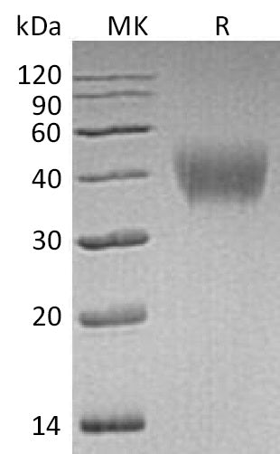 BL-0519NP: Greater than 95% as determined by reducing SDS-PAGE. (QC verified)Recombinant Human HepaCAM Protein (C-6His)
