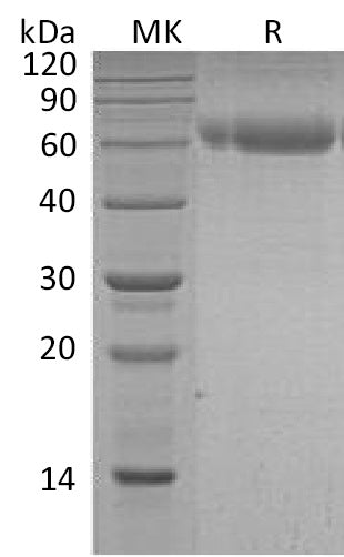 BL-2241NP: Greater than 95% as determined by reducing SDS-PAGE. (QC verified)Recombinant Human Serpin A7 Protein (C-6His)