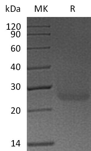 BL-0522NP: Greater than 95% as determined by reducing SDS-PAGE. (QC verified)Recombinant Human PDPN Protein (C-6His)