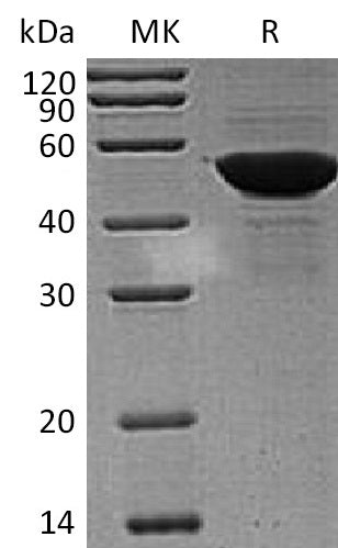 BL-1353NP: Greater than 95% as determined by reducing SDS-PAGE. (QC verified)Recombinant Human PDIA6 Protein (C-6His)
