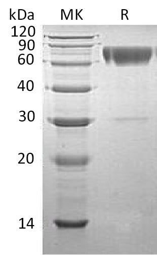 BL-0528NP: Greater than 90% as determined by reducing SDS-PAGE. (QC verified)Recombinant Human Serpin A3 Protein (C-6His)