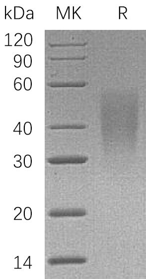 BL-0405NP: Greater than 95% as determined by reducing SDS-PAGE. (QC verified)Recombinant Human CD58 Protein (C-6His)
