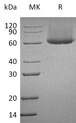 BL-0410NP: Greater than 95% as determined by reducing SDS-PAGE. (QC verified)Recombinant Human CRTAM Protein (C-6His)