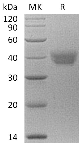 BL-0418NP: Greater than 95% as determined by reducing SDS-PAGE. (QC verified)Recombinant Human ESAM Protein (C-6His)