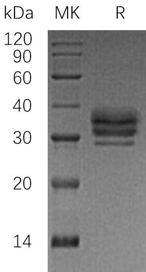 BL-0408NP: Greater than 95% as determined by reducing SDS-PAGE. (QC verified)Recombinant Human LTBR Protein (C-6His)