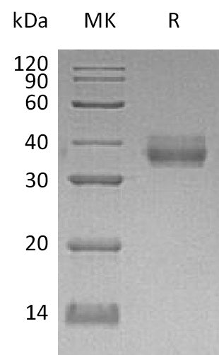 BL-0416NP: Greater than 95% as determined by reducing SDS-PAGE. (QC verified)Recombinant Human EpCAM Protein (C-6His)