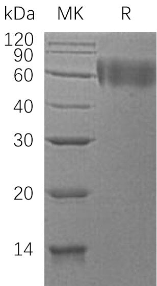 BL-0407NP: Greater than 95% as determined by reducing SDS-PAGE. (QC verified)Recombinant Human DR6 Protein (C-6His)