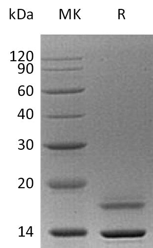 BL-0412NP: Greater than 95% as determined by reducing SDS-PAGE. (QC verified)Recombinant Human CST6 Protein (C-6His)