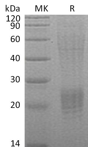BL-2239NP: Greater than 90% as determined by reducing SDS-PAGE. (QC verified)Recombinant Human ESM-1 Protein (C-6His)