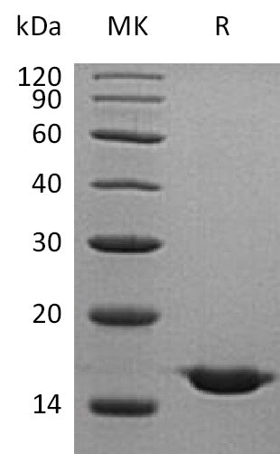 BL-0415NP: Greater than 95% as determined by reducing SDS-PAGE. (QC verified)Recombinant Human CST2 Protein (C-6His)