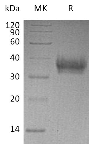 BL-0417NP: Greater than 95% as determined by reducing SDS-PAGE. (QC verified)Recombinant Human EPCR Protein (C-6His)