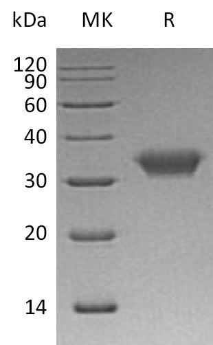BL-0411NP: Greater than 95% as determined by reducing SDS-PAGE. (QC verified)Recombinant Human CAR Protein (C-6His)