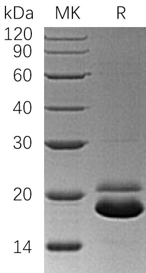 BL-0406NP: Greater than 95% as determined by reducing SDS-PAGE. (QC verified)Recombinant Human TRAIL R2 Protein (C-6His)