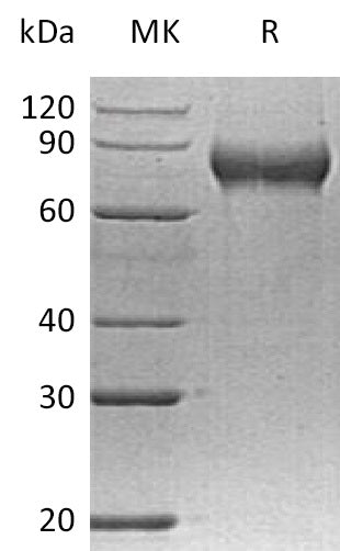 BL-0423NP: Greater than 95% as determined by reducing SDS-PAGE. (QC verified)Recombinant Human FLRT2 Protein (C-6His)