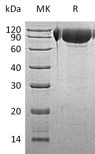BL-1319NP: Greater than 95% as determined by reducing SDS-PAGE. (QC verified)Recombinant Human GNS Protein (C-6His)