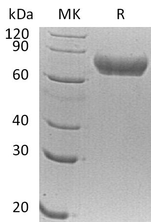 BL-0422NP: Greater than 95% as determined by reducing SDS-PAGE. (QC verified)Recombinant Human FLRT1 Protein (C-6His)