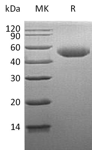 BL-1318NP: Greater than 95% as determined by reducing SDS-PAGE. (QC verified)Recombinant Human GLA Protein (C-6His)