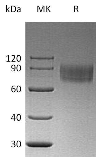 BL-0425NP: Greater than 95% as determined by reducing SDS-PAGE. (QC verified)Recombinant Human IFNAR1 Protein (C-6His)