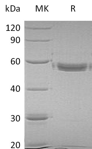 BL-1327NP: Greater than 95% as determined by reducing SDS-PAGE. (QC verified)Recombinant Human MMP-1 Protein (C-6His)