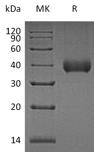BL-1321NP: Greater than 95% as determined by reducing SDS-PAGE. (QC verified)Recombinant Human KLK11 Protein (C-6His)