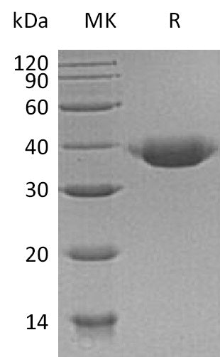 BL-0426NP: Greater than 95% as determined by reducing SDS-PAGE. (QC verified)Recombinant Human JAM-B Protein (C-6His)