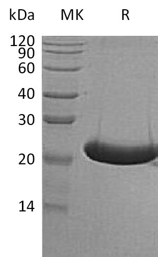 BL-0443NP: Greater than 95% as determined by reducing SDS-PAGE. (QC verified)Recombinant Human TREML1 Protein (C-6His)