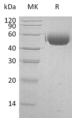 BL-2308NP: Greater than 95% as determined by reducing SDS-PAGE. (QC verified)Recombinant Human SIRPA Protein (C-6His)