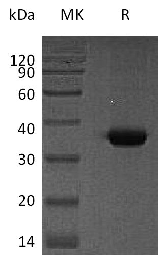 BL-0440NP: Greater than 95% as determined by reducing SDS-PAGE. (QC verified)Recombinant Human SPARC Protein (C-6His)